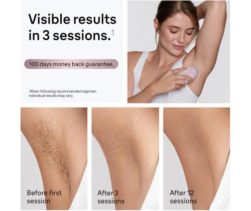 Braun Silk-expert Mini, roosa - Fotoepilaator